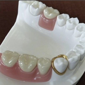 精度の添付ファイル